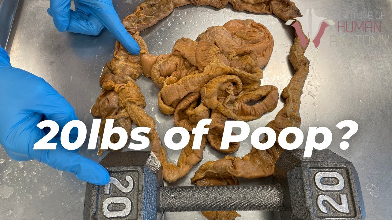 How Much Poop Is Stored in Your Colon