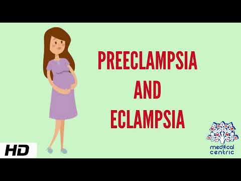 Preeclampsia and Eclampsia, Causes, Signs and Symptoms, Diagnosis and Treatment.