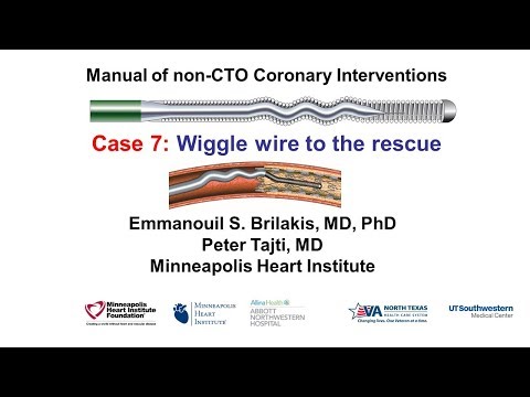 Case 7: PCI Manual - Wiggle wire to the rescue