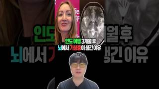 Download lagu Parasites After a 3-Month Trip to India... mp3 Download lagu Parasites After a 3-Month Trip to India... mp3