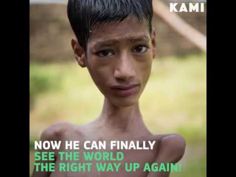 The boy who saw the world upside down