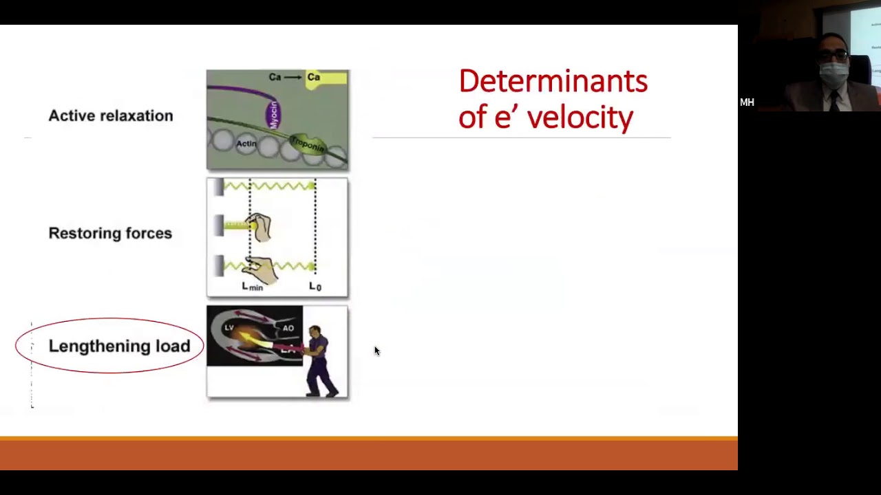 Assessment of LV diastolic function - Dr.  Mohamed Hassan