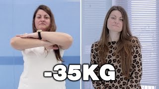 Método POSE Antes y Después | Testimonios Clínicas Diego de León