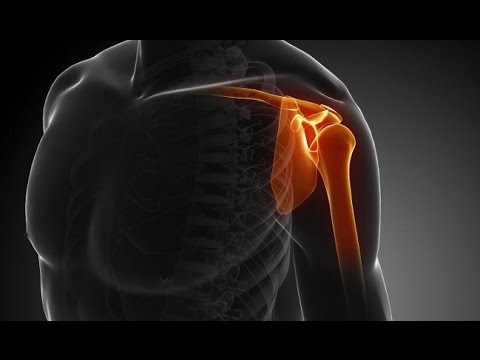 ✅ Schulterschmerzen & Schulterprobleme hier LÖSUNGEN | Bizepssehne & Impingement 👇