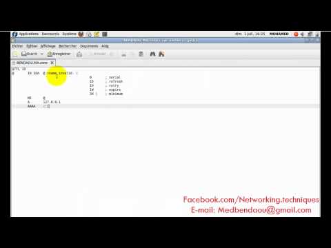 comment installer dns
