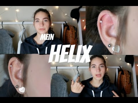 Arthrose des Kniegelenks verursacht Symptome Schäden am Unterarm Ellenbogen