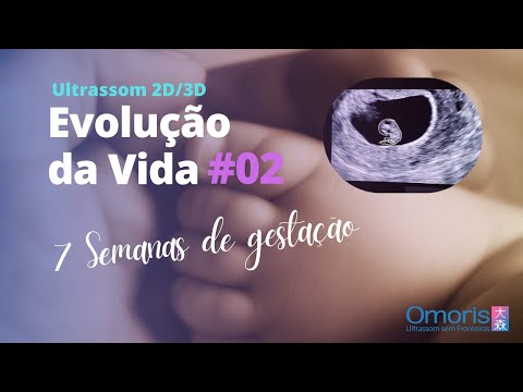 Gravidez semana a semana AO VIVO - Ultrassom 7 semanas - Evolução da Vida #02