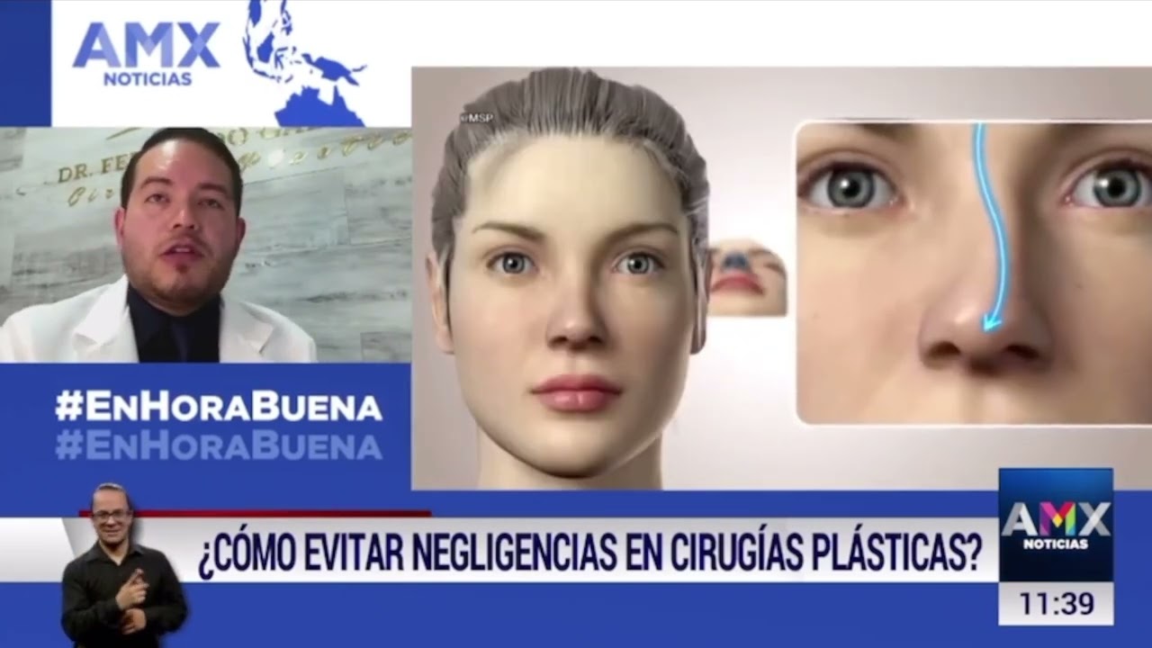 Fernando Gallardo-19