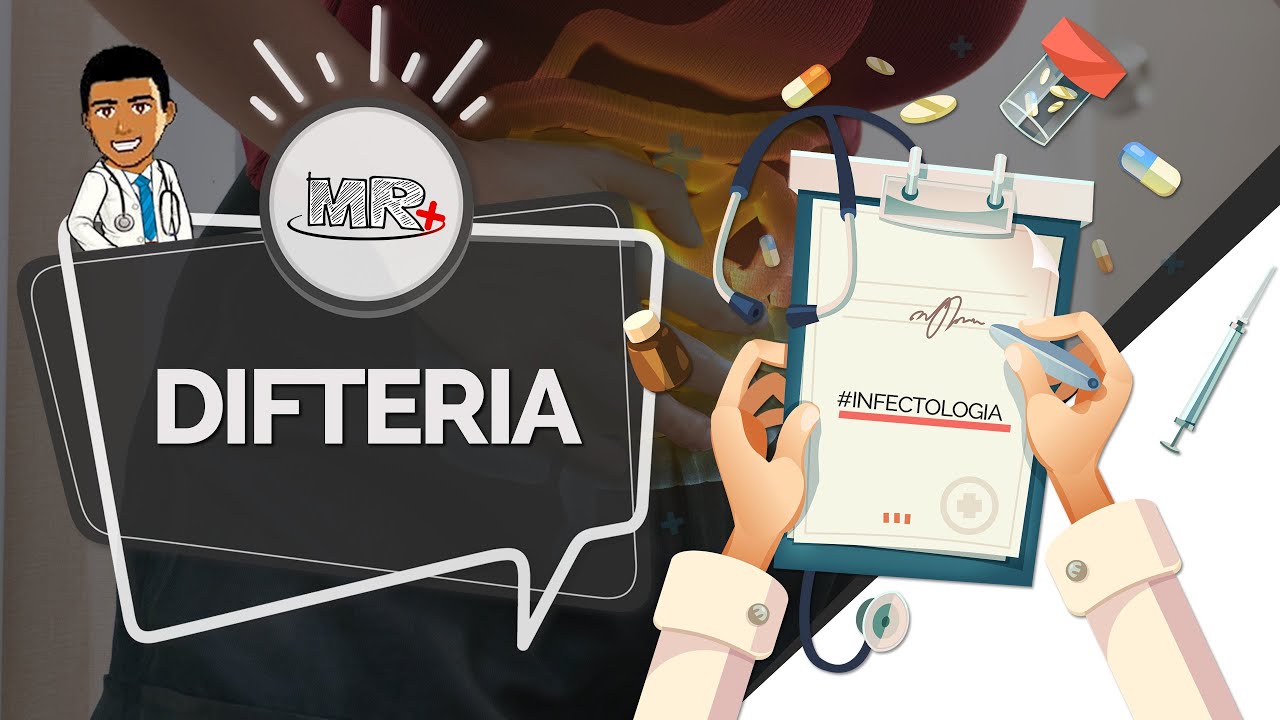 Difteria - Aula de revisão de Infectologia do MR Plus