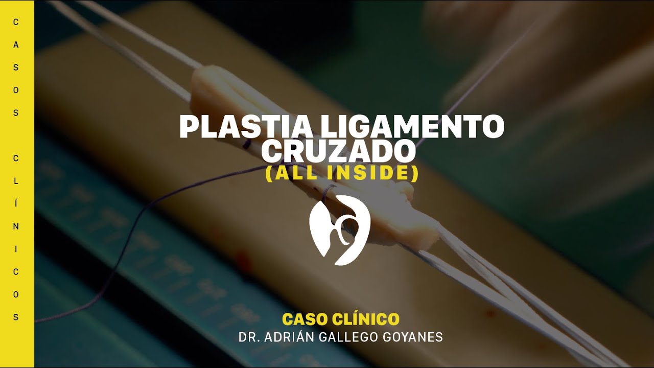 Adrián Gallego Goyanes-34