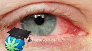 How To Get Rid of Red Eyes & High FASTER