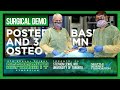 Posterior Bases and 3 Column Osteotomies - Stephen Lewis, M.D.