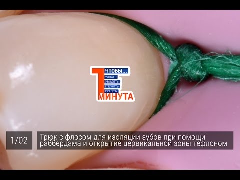 Трюк с флосом для изоляции зубов при помощи раббердама и открытие цервикальной зоны тефлоном