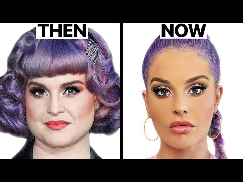 Kelly Osbourne Plastic Surgery - Surgeon Reacts