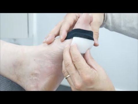 Podo-Taping-Concept© - Großzehengrundgelenk (Sesambeinentlastung)