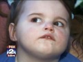 Zoe Nicholas Local News Story 2 Diagnosed With CDKL5