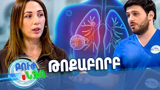Բուժ ինֆո/Buj Info/ Գլխավոր / Ինչպե՞ս է բուժվում թոքաբորբն այսօր