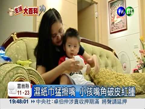 濕紙巾猛擦嘴 小孩嘴破罹皮膚炎