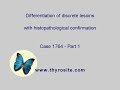 Differentiation Of Discrete Lesions Case 1764 Part 1