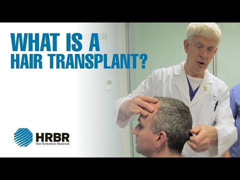 What is a hair transplant? - Hair Restoration Blackrock