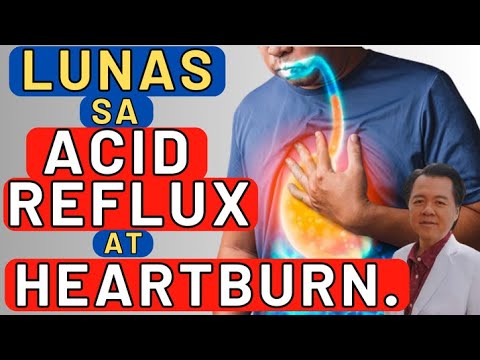 Lunas sa Acid Reflux at Heartburn - By Doc Willie Ong (Internist and Cardiologist)