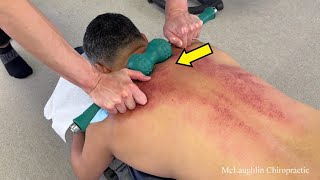 FIX Your Neck And Back! Saving A Hardworking Man's Spine - YOU Need This Treatment To Get Better