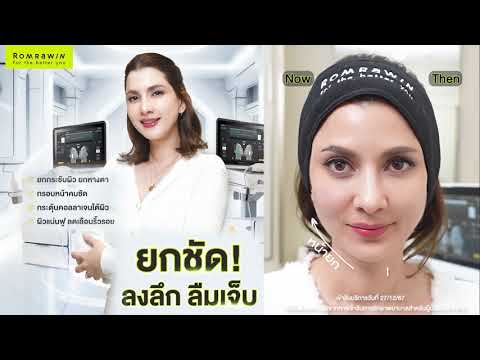 รีวิว Ulthera Prime คุณเปิ้ล ภารดี ยกกระชับผิวหน้ายิงไวสบายผิว