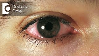 How to manage swollen & sensitive eyes after injury? - Dr. Elankumaran P