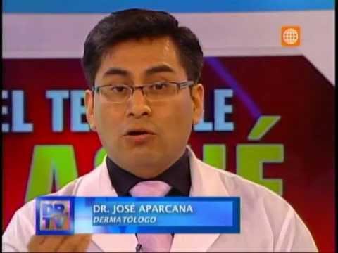 Tratamiento de cicatrices de acné en Dr. TV