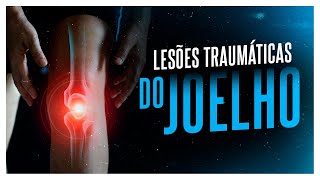 BATI O JOELHO - SAIBA QUAIS LESÕES VOCÊ PODE TER