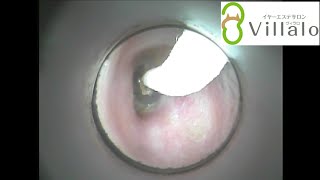 耳掃除動画vol.40「アップ希望 落とし物を回収」