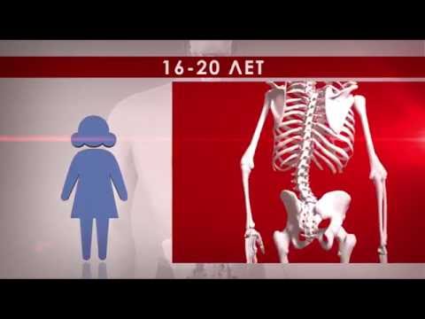 Осанка какие упражнения Как проходит операция сколиоз