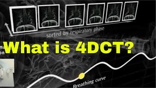 What is 4DCT?