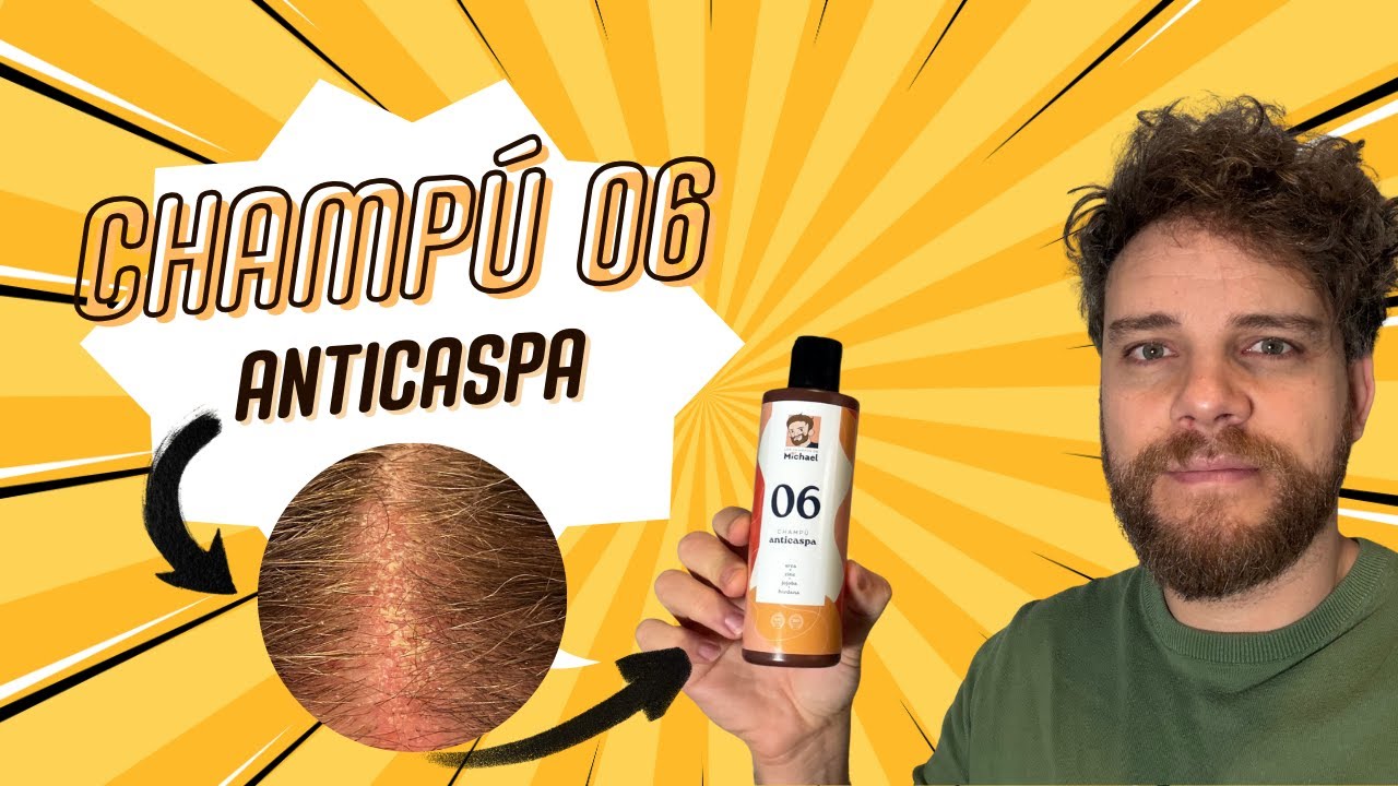 Champú 06 anticaspa con ingredientes naturales.¿Por qué es mi champú favorito para el liquen plano?