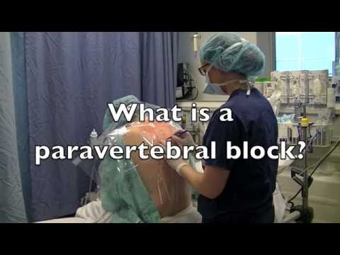 1 Paravertebral Block