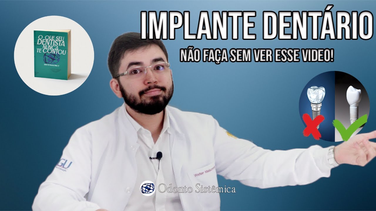 Implante Dentário - Não faça sem antes ver esse vídeo