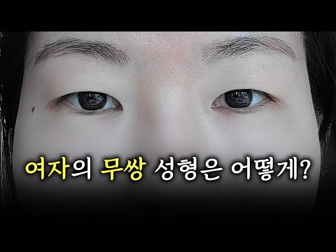 单眼皮 03