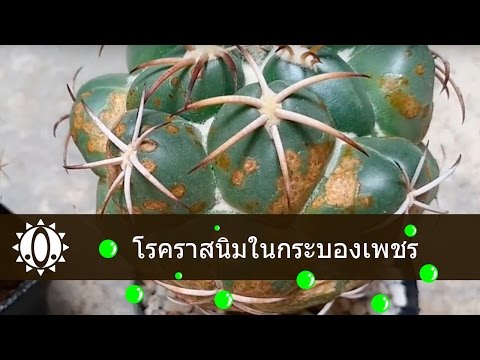 อาการโรคสะเก็ดเงินกลากขุย Sebo-โรคสะเก็ดเงินในมือของเขา