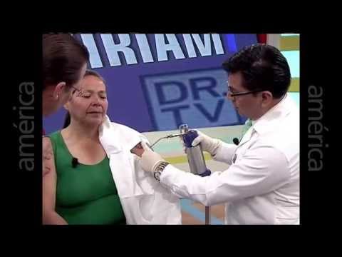 Caso real de Queloide presentado en Dr.Tv con el Dr. Aparcana – 6 años de experiencia en queloide