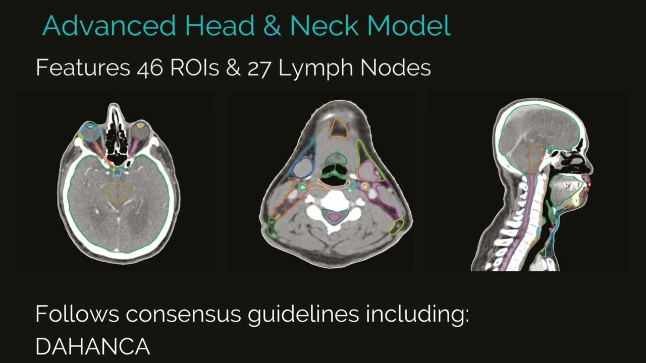 Guideline Based Segmentation (GBS™) Solutions - MVision AI