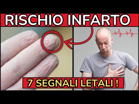 Pressione alta: 7 segnali LETALI e SILENZIOSI da non IGNORARE!