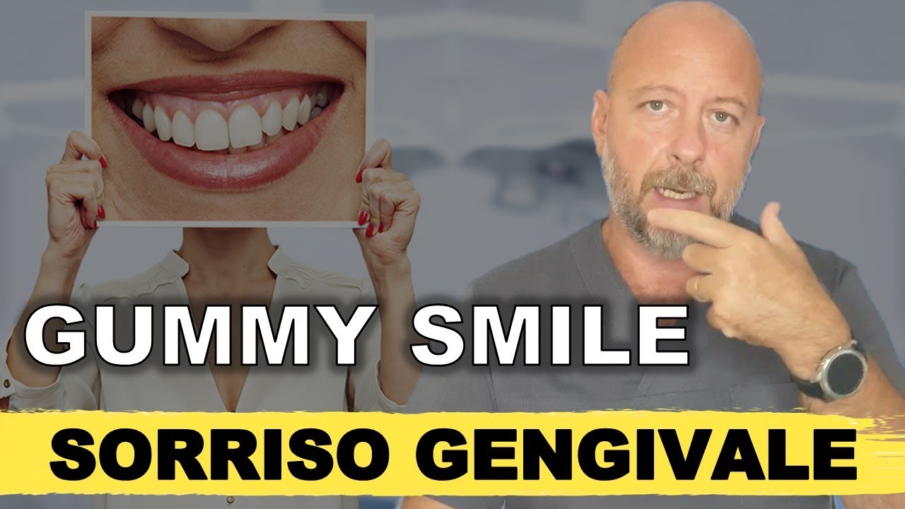 Quando ridi si vedono le gengive E' il sorriso gengivale o GUMMY SMILE: le cause e come risolverlo