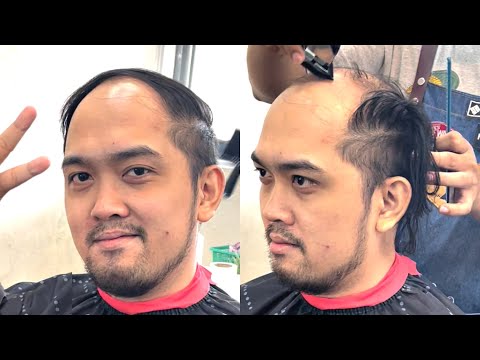 Saying GOODBYE to my COMBOVER