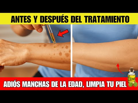 Dermatólogo revela: Frota ESTO en tu piel y las manchas desaparecen para siempre.