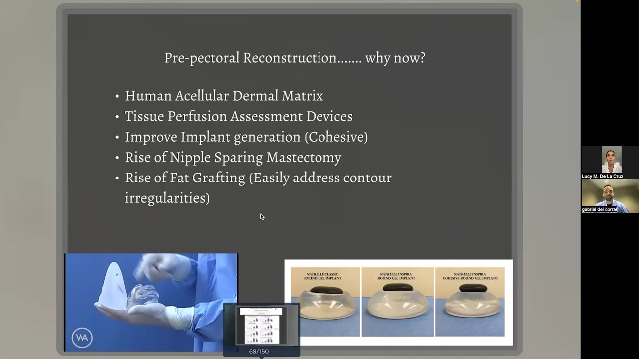 Surgical Options and Updates for Breast Cancer