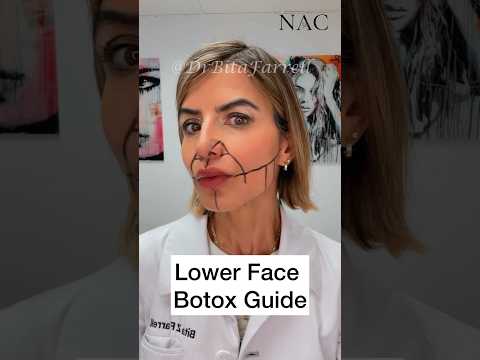 Lower Face Botox  #lowerfacebotox #botoxdosing #botoxtraining #drbitafarrell