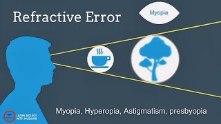 Refractive Error | Myopia, Hyperopia, Astigmatism and Presbyopia