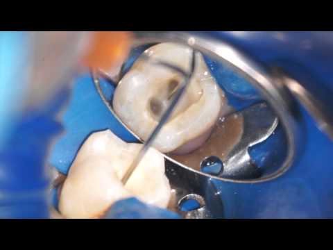 Dr. Scott Norton - Shaping the Canal Space