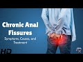 Anal Fissures Pain Here S How To Get Fast Relief