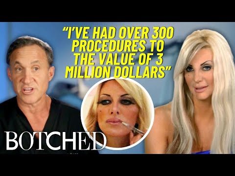 REJECTED by Botched: “Bionic Woman” Injects HERSELF With Fillers After 300+ Surgeries | Botched | E!